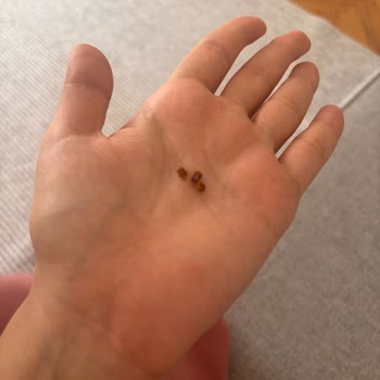 Grosper Tadelle Çikolatasında Sert Fındık Parçaları Nedeniyle Diş Ağrısı Ve Gıda Güvenliği Şikayeti