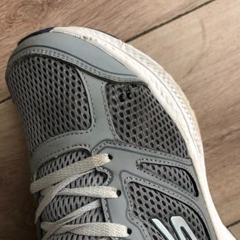 Skechers Ayakkabısında 3 Ayda Deformasyon, Üretim Hatası İade Talebi