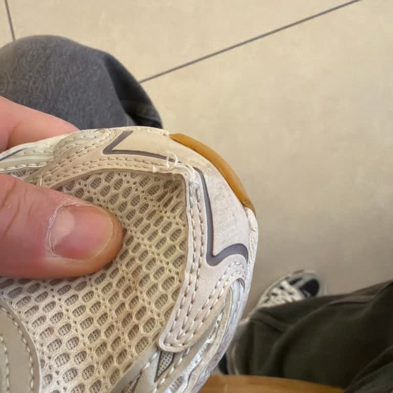 Kısa Sürede Bozulmuş Skechers Ayakkabı Değişim İsteği