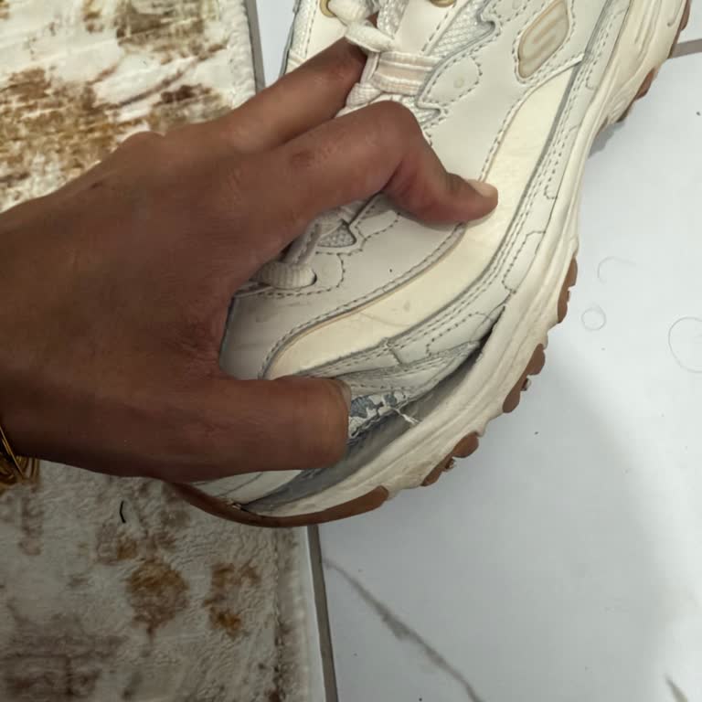 Skechers D’Lites Ayakkabısının Kısa Sürede Tabana Ayrılması Ve Garanti Reddi