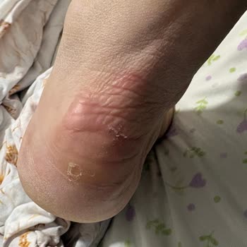 Ayağımı Yaran Nike Ayakkabı İçin FLO’dan Değişim Ve İade Talebi