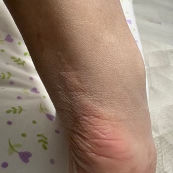 Ayağımı Yaran Nike Ayakkabı İçin FLO’dan Değişim Ve İade Talebi