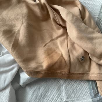 Prima Bebek Bezlerinde Sürekli Sızdırma Ve Kızarıklık Sorunu