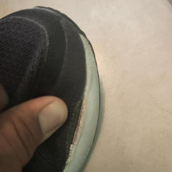 Az Kullanılan Adidas Yazlık Ayakkabıda Hızlı Yıpranma Ve Fotoğrafla Reddedilen İnceleme