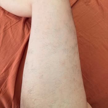 Enza Aesthetic Beauty'de Zorunlu Ek Ücret ve Tamamlanmamış Lazer Epilasyon Garantisi