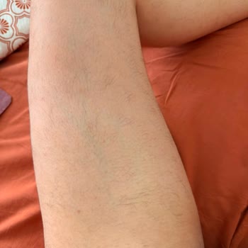 Enza Aesthetic Beauty'de Zorunlu Ek Ücret ve Tamamlanmamış Lazer Epilasyon Garantisi