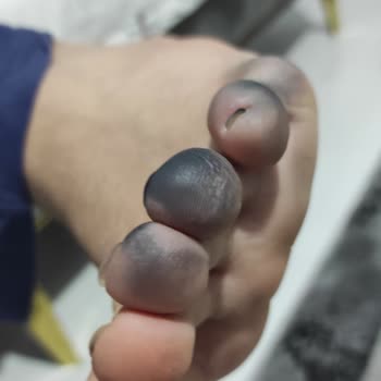 Puma Ayakkabısının Boya Sızdırması Ve In Street Mağazasının Kullanıcı Hatası İddiası