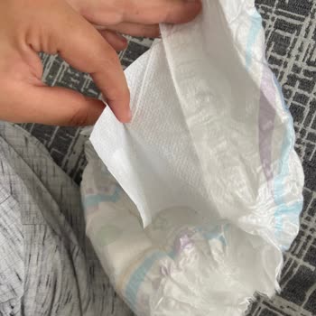 Molfix Bebek Bezinde Yabancı Parça Bulunması Ve Telafi Talebi