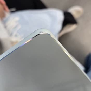 Teknosa Servisinde Tablet Hasarı Ve Garanti Süresi Kaybı