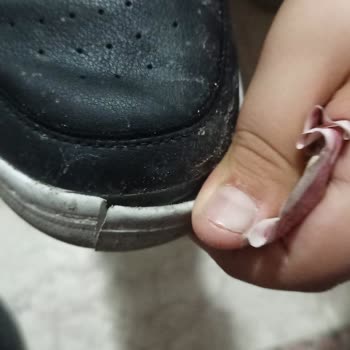 Reebok Ayakkabısının Kısa Sürede Çürümesi Ve FLO Mağazasının Destek Vermemesi