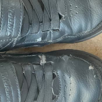 Hepsiburada Ve Skechers Ayakkabısında Üçüncü Kullanımda Deri Dökülmesi Ve İade Reddi