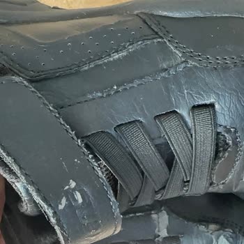 Hepsiburada Ve Skechers Ayakkabısında Üçüncü Kullanımda Deri Dökülmesi Ve İade Reddi