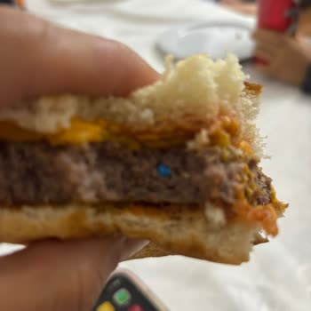 Migros Kasap Büfesinde Plastik Parça Bulunması Ve Çocukta Boğaz Tıkanıklığı