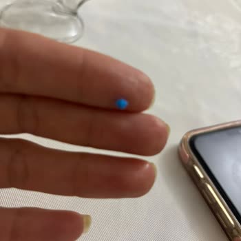 Migros Kasap Büfesinde Plastik Parça Bulunması Ve Çocukta Boğaz Tıkanıklığı