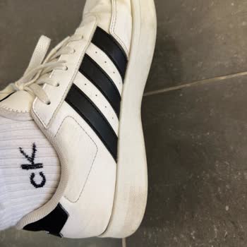 Adidas Erkek Ayakkabısının Topuk Ayrılması Ve Değişim Talebi