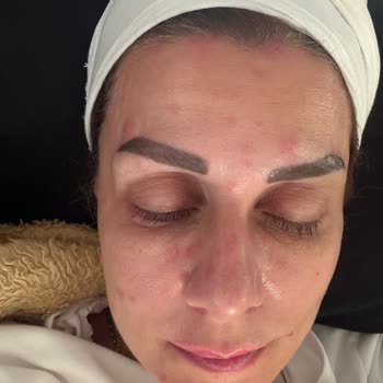 Hasta Bilgilendirme Hakkının Göz Ardı Edilmesi Ve Doktorun Umursamaz Tutumu