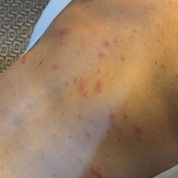 Hasta Bilgilendirme Hakkının Göz Ardı Edilmesi Ve Doktorun Umursamaz Tutumu