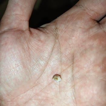 Köfteci Yusuf'ta Diş Parçası İçeren Tatlı İçin Şok Ve Hijyen İhlali