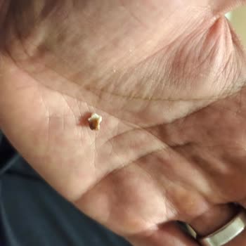 Köfteci Yusuf'ta Diş Parçası İçeren Tatlı İçin Şok Ve Hijyen İhlali