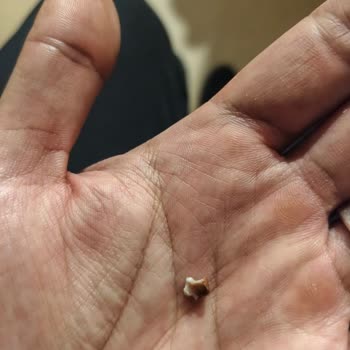 Köfteci Yusuf'ta Diş Parçası İçeren Tatlı İçin Şok Ve Hijyen İhlali