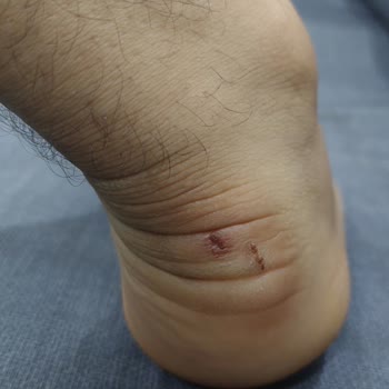 Nike Ayakkabıda Garanti İhlali Ve Sağlık Sorunu Nedeniyle İade Reddi Kabul Edilemez