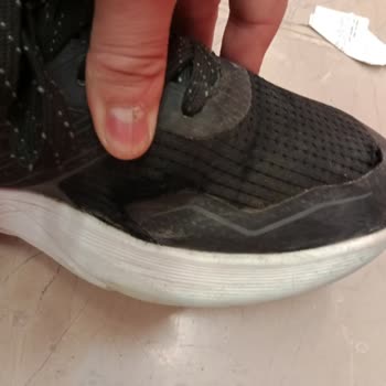 Yan Tarafı Açılan Kinetix Running Ayakkabıda Üretim Kusuru Ve İade Talebi