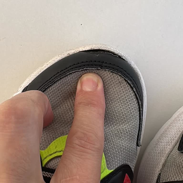 Adidas Ayakkabısında Açılma Ve Ayıplı Ürün Olarak İade Reddi