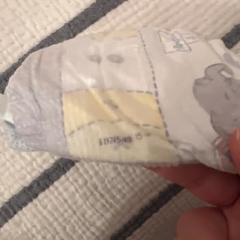 Yeni Seri Prima Pampers Bebek Bezinde Şiddetli Pişik Sorunu