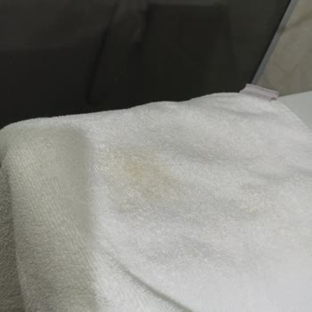 Kapadokya Otelinde Hijyen, Sigara Ve Yemek Çeşitliliği Sorunları