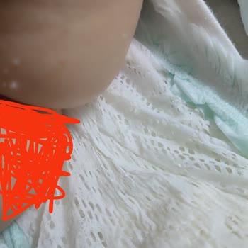 Prima Premium Care Bebek Bezinde Kaçak Ve Cilt Tahrişi Şikayeti
