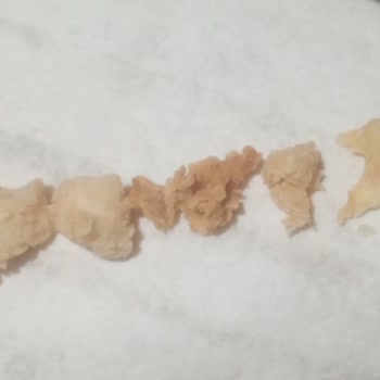 Trendyol Yemek'te Nugget Porsiyon Sorunu Ve İade Reddi