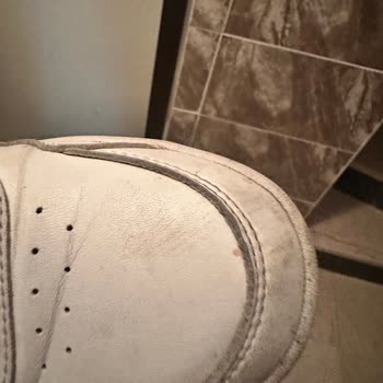 Adidas Ayakkabısındaki Üretim Hatası Ve Garanti Redleri
