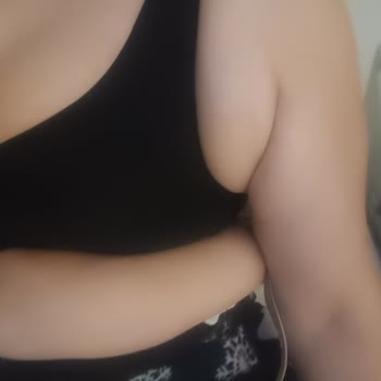 Plastik Cerrahi Bölümünde Tekrarlanan Ameliyat Sonrası Yanıt Alamama Ve Düzeltme Eksikliği