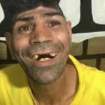 Bein