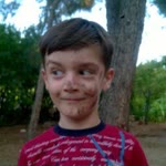Erdal