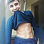 Recep