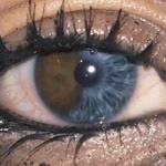 Memetali