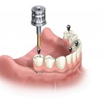Zdental