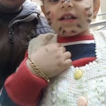 Erdal