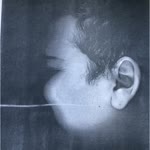 Anil