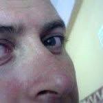 Ersin